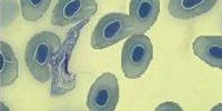 protozoal-disease